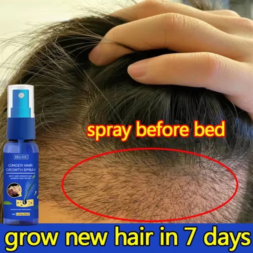 Hair Care Tonic - Snelle gember haar groeispray, wortelversterkend, tegen